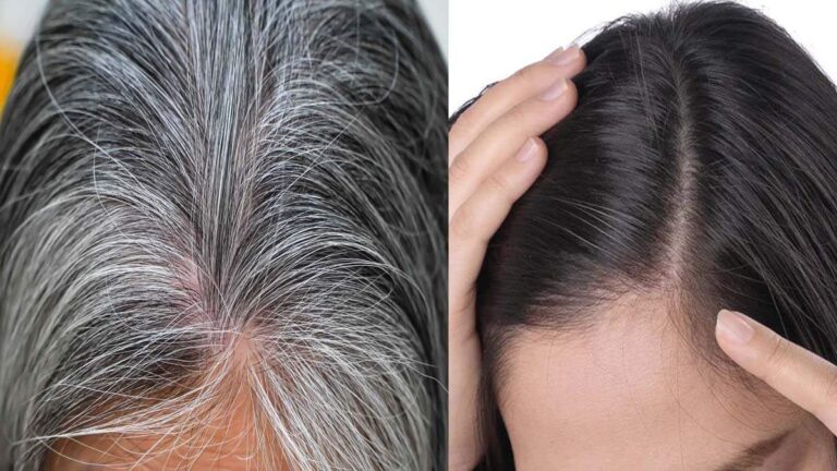 कम उम्र में बाल सफेद हो रहे हैं? ये प्राकृतिक उपाय हैं जवाब