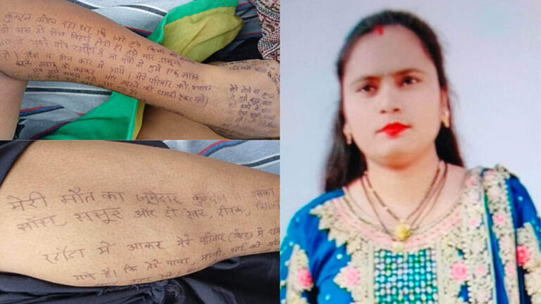 ‘भूख से तड़पती रही, मारा-पीटा भी गया’, पति पर गंभीर आरोप, हाथ-पैर पर सुसाइड नोट लिख दी जान
